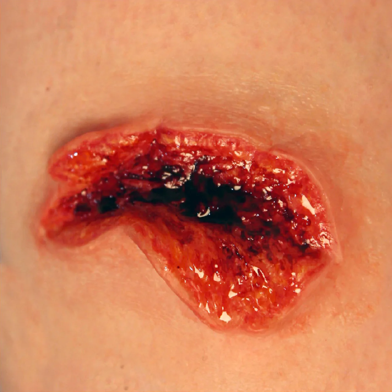 Avulsion Molds Large - Image 2
