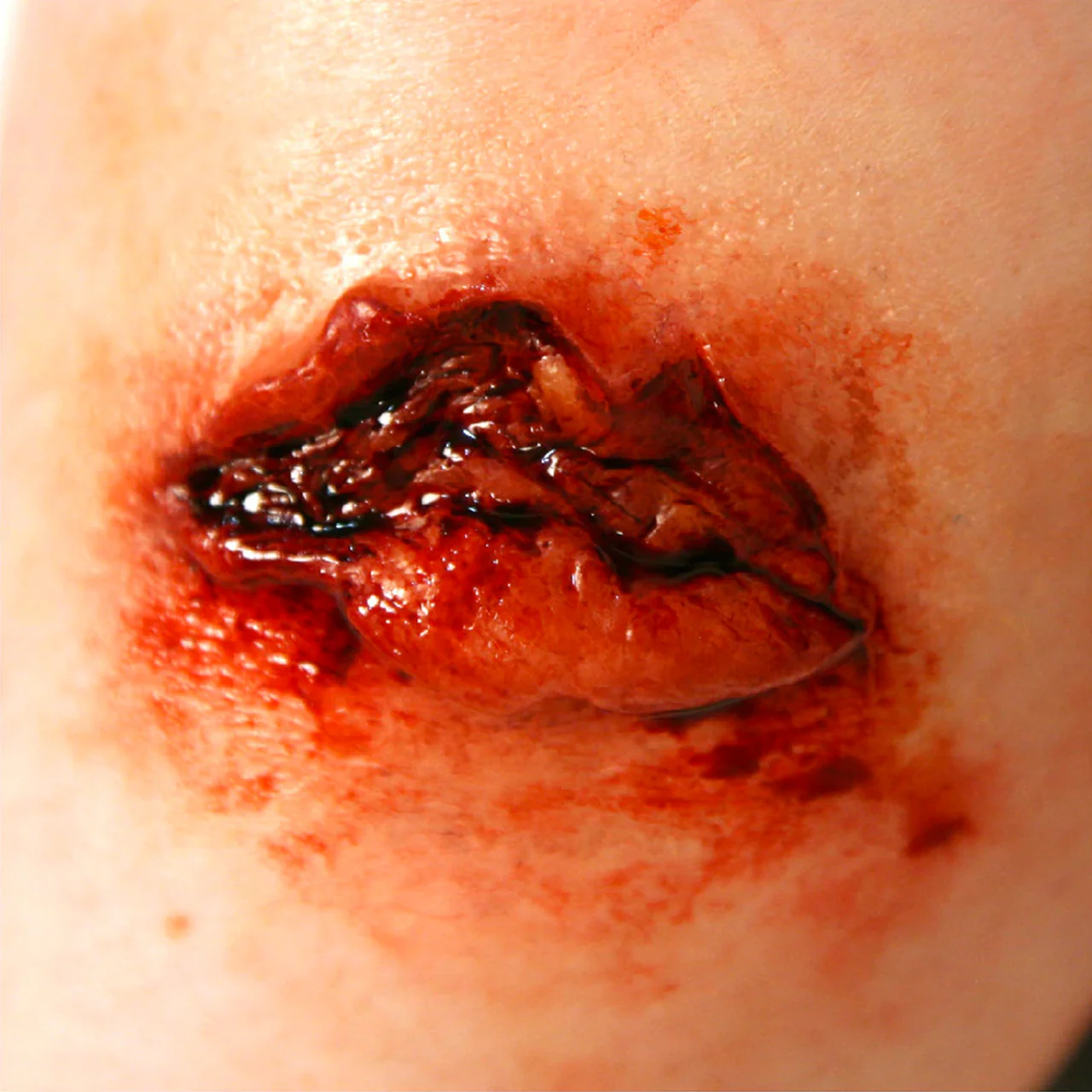 Avulsion Molds Medium - Image 2