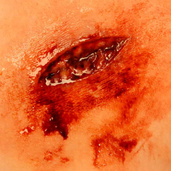Laceration Molds 3'' - Image 3