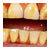 Mouth FX - Image 30