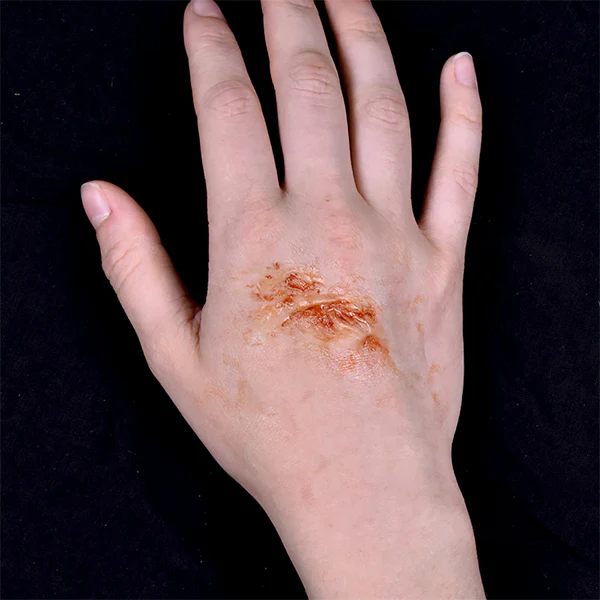 Peel N' Stick Prosthetics, Burn (XS) - Image 3