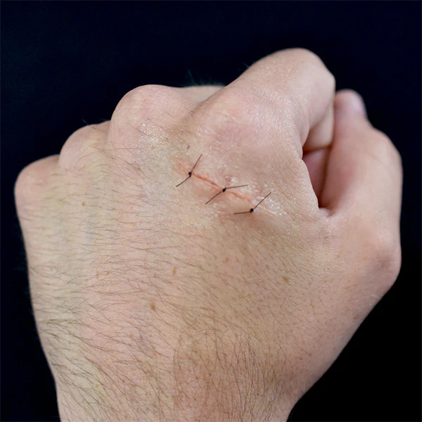 Peel N' Stick Prosthetics, Sutured Wound 3 Stitch - Image 3