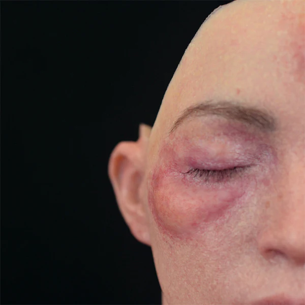 Peel N' Stick Prosthetics, Swollen Right Eye (Medium) - Image 3